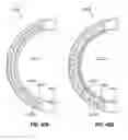 Fig. 40 - Adjustable annuloplasty ring activation system