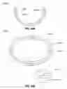 Fig. 41 - Adjustable annuloplasty ring activation system
