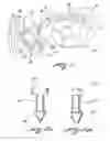 Fig. 02 - Implant capable of forming a differential image in an eye and methods of inserting and locating same