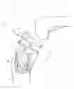 Fig. 01 - Joint replacement prosthesis, joint replacement mounting stud and method