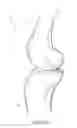 Fig. 02 - Joint replacement prosthesis, joint replacement mounting stud and method