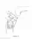 Fig. 08 - Joint replacement prosthesis, joint replacement mounting stud and method