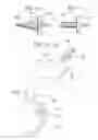 Fig. 07 - Osteochondral allografts