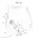 Fig. 09 - Osteochondral allografts