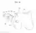 Fig. 10 - Osteochondral allografts