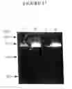 Fig. 14 - Genes encoding several poly (ADP-ribose) glycohydrolase (PARG) enzymes, the proteins and fragments thereof, and antibodies immunoreactive therewith