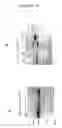 Fig. 19 - Genes encoding several poly (ADP-ribose) glycohydrolase (PARG) enzymes, the proteins and fragments thereof, and antibodies immunoreactive therewith