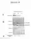Fig. 20 - Genes encoding several poly (ADP-ribose) glycohydrolase (PARG) enzymes, the proteins and fragments thereof, and antibodies immunoreactive therewith