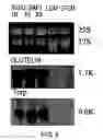 Fig. 06 - Method of accumulating allergen-specific t cell antigen determinant in plant and plant having the antigen determinant accumulated therein