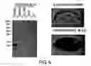 Fig. 07 - Method of accumulating allergen-specific t cell antigen determinant in plant and plant having the antigen determinant accumulated therein