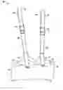 Fig. 01 - Walking training apparatus