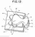 Fig. 13 - Waterproof slide fastener