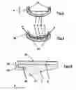 Fig. 06 - Callouse plane