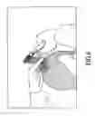 Fig. 07 - Barber tool