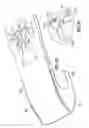Fig. 07 - Wear assembly