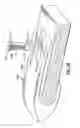 Fig. 10 - Wear assembly