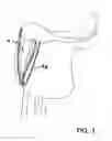 Fig. 03 - Saddles