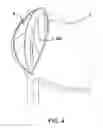 Fig. 04 - Saddles