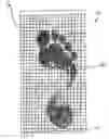 Fig. 01 - System and method for measuring plantar foot pressure