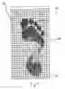 Fig. 05 - System and method for measuring plantar foot pressure