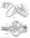 Fig. 02 - Pressure sensor over-pressure protection