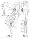 Fig. 04 - Bicycle operating component with electrical shift control switch