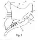 Fig. 06 - Bicycle operating component with electrical shift control switch