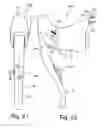 Fig. 12 - Bicycle operating component with electrical shift control switch