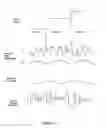 Fig. 13 - Expressive music synthesizer with control sequence look ahead capability