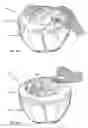 Fig. 19 - Salad spinner