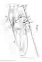 Fig. 10 - Marine Drive with Integrated Trim Tab