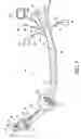 Fig. 04 - Visualization esophageal-tracheal airway apparatus and methods