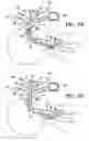 Fig. 05 - Visualization esophageal-tracheal airway apparatus and methods