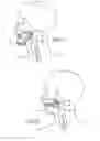 Fig. 07 - Devices, systems and methods using titrated magnetic force systems