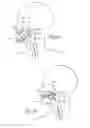 Fig. 07 - Devices, systems and methods using magnetic force systems affecting the tongue or hyoid muscles in the upper airway
