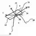 Fig. 01 - Contact over-torque with three-dimensional anatomical data