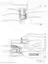 Fig. 02 - Active chassis for a motor vehicle
