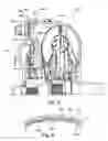Fig. 05 - Clutch attached to an outer rim of a torque converter