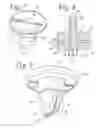 Fig. 04 - Vacuum breaker arrangement with externally protruding collapsible valve part