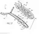 Fig. 28 - Removable grip for handle
