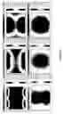 Fig. 40 - Hand-supportable digital image capturing and processing system employing an area-type image sensing array exposed to illumination from an LED-based illumination array only when all sensor elements in said image-sensing array are activated and in a state of integration