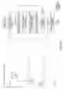 Fig. 77 - Digital image capturing and processing system employing an area-type image sensing array exposed to narrow-band illumination from a narrow-band illumination subsystem for a time duration controlled using a photodetector operated independently from said area-type image sensing array