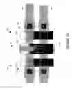 Fig. 12 - Electrically floating body memory cell and array, and method of operating or controlling same