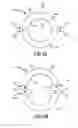 Fig. 09 - MULTI-STAGE FERROFLUIDIC SEAL HAVING ONE OR MORE SPACE-OCCUPYING ANNULUS ASSEMBLIES SITUATED WITHIN ITS INTERSTAGE SPACES FOR REDUCING THE GAS LOAD THEREIN