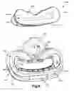 Fig. 08 - Guide for seat belt webbing having a deformable insert