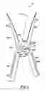 Fig. 03 - Garden tool