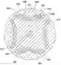 Fig. 01 - Asymmetrical composite magnet structure for lobed rotor