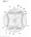 Fig. 05 - Asymmetrical composite magnet structure for lobed rotor