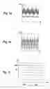 Fig. 02 - Detection of the amount of wear on a motor drive system