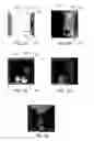 Fig. 06 - Global illumination filtering methods and apparatus